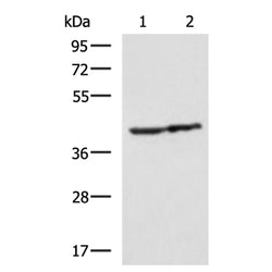 TMOD1 rabbit polyclonal antibody