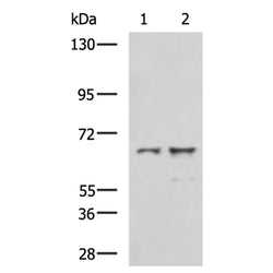 GPD2 rabbit polyclonal antibody
