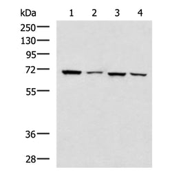 DNAI2 rabbit polyclonal antibody