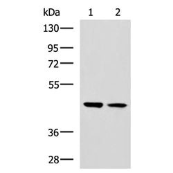 GLT8D1 rabbit polyclonal antibody