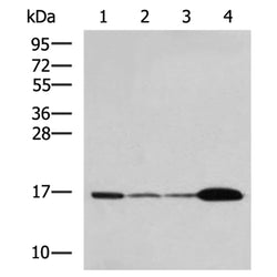 UBE2N rabbit polyclonal antibody