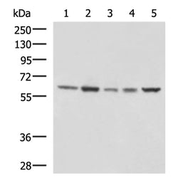 GPI rabbit polyclonal antibody