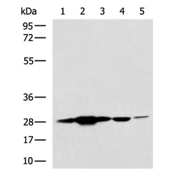 PGAM2 rabbit polyclonal antibody