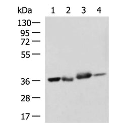 SPRY2 rabbit polyclonal antibody