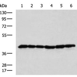DNAJB11 rabbit polyclonal antibody
