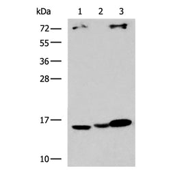 UBE2D1 rabbit polyclonal antibody