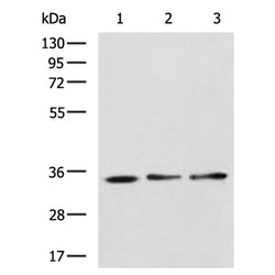 DUSP15 rabbit polyclonal antibody