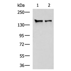 STAG1 rabbit polyclonal antibody