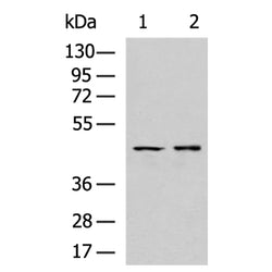 PDGFRL rabbit polyclonal antibody