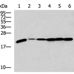 RPL17 rabbit polyclonal antibody