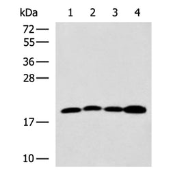 TAGLN2 rabbit polyclonal antibody