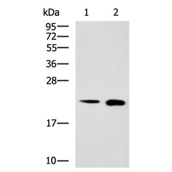 SRI rabbit polyclonal antibody