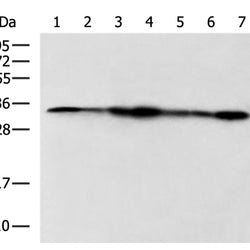 PSMA1 rabbit polyclonal antibody