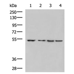 TUBB mouse monoclnal antibody