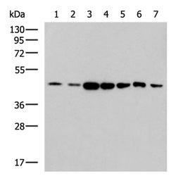 ACTB mouse monoclnal antibody