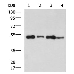 TUBA1B mouse monoclnal antibody
