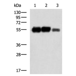 TUBB3 mouse monoclnal antibody