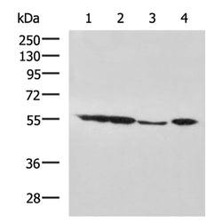 AKT1 mouse monoclnal antibody