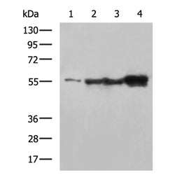 VIM mouse monoclnal antibody