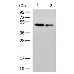 TP53 mouse monoclnal antibody