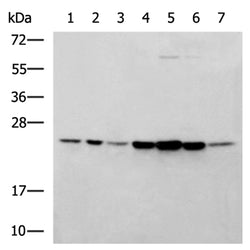 PSMB2 rabbit polyclonal antibody