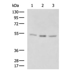 TINAGL1 rabbit polyclonal antibody