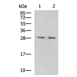 KCNIP4 rabbit polyclonal antibody