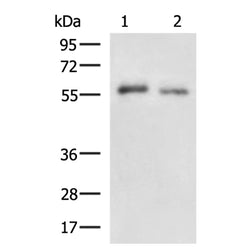 STEAP2 rabbit polyclonal antibody
