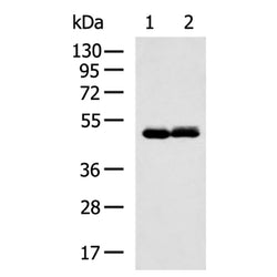 KRT7 mouse monoclnal antibody
