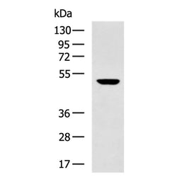 KRT17 mouse monoclnal antibody