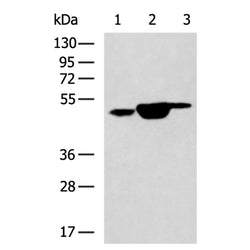 KRT18 mouse monoclnal antibody