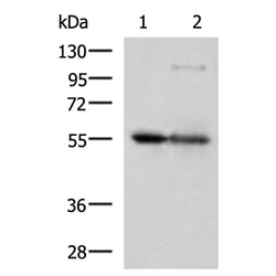 LPCAT2 rabbit polyclonal antibody