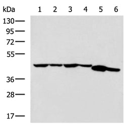 AMACR mouse monoclnal antibody