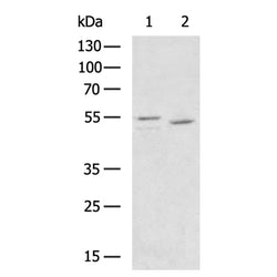 GBA rabbit polyclonal antibody