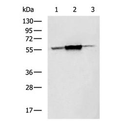 CYP51A1 rabbit polyclonal antibody