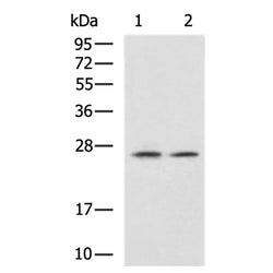 RAB29 rabbit polyclonal antibody