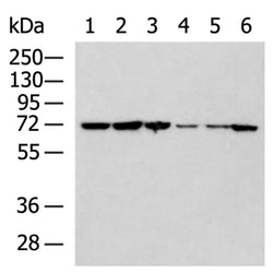 NOP58 rabbit polyclonal antibody