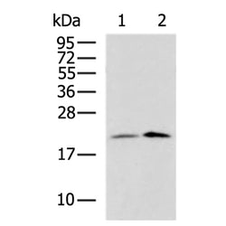 RPS10 rabbit polyclonal antibody