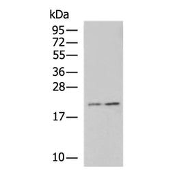 PLLP rabbit polyclonal antibody