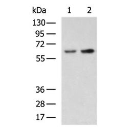HEXB rabbit polyclonal antibody