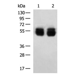 KRT8 mouse monoclnal antibody