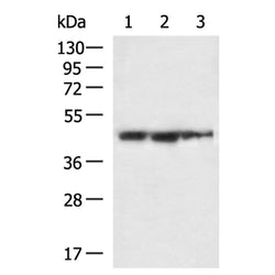 ACTA1 mouse monoclnal antibody