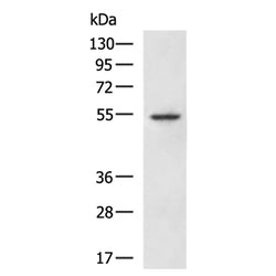 CASP8 mouse monoclnal antibody