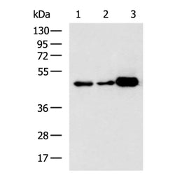 GSK3B mouse monoclnal antibody