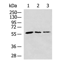 PGM3 rabbit polyclonal antibody
