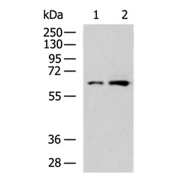 PGM1 rabbit polyclonal antibody