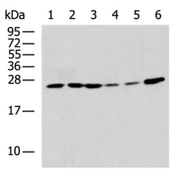 RPS7 rabbit polyclonal antibody