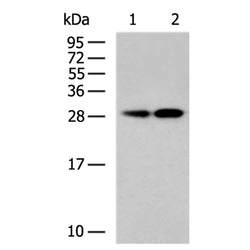 TRPT1 rabbit polyclonal antibody