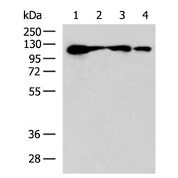 DDX24 rabbit polyclonal antibody