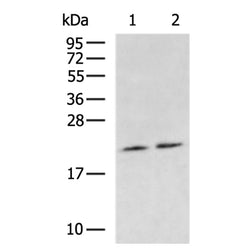 NRAS rabbit polyclonal antibody